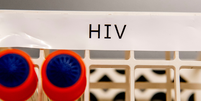 Diretoria da Fundação Saúde renuncia após casos de órgãos infectados por HIV no RJ  Foto: Reprodução/Getty Images