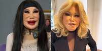 Lyn May e Jocelyn Wildestein: plásticas sucessivas resultaram em aparência nada natural  Foto: Reproduções/TV/TikTok