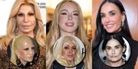 O antes e depois de Donatella Versace, Lindsay Lohan e Demi Moore: milhões gastos para corrigir procedimentos desastrosos e renovar a aparência  Foto: Jeff Spicer/Getty Images, Gilbert Carrasquillo/GC Images e Reproduções/Instagram