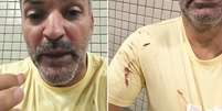 Pai afirma que filha de 14 anos foi atingida por bala perdida em Réveillon de Copacabana  Foto: Reprodução/Instagram