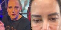 Silvia Abravanel surge com o rosto inchado  Foto: Reprodução/ Instagram / Contigo