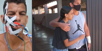 Homem com a 'pior dor do mundo' passa por 20 cirurgias em 10 anos: 'Peço socorro'  Foto: Reprodução/ Instagram e EPTV / Contigo