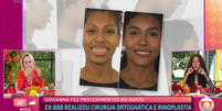 Giovanna conta sobre cirurgia ortognática no 'Mais Você'  Foto: Reprodução/Globo