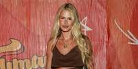 'Fantástico' aborda o Lipedema: em matéria na TV Globo, Yasmin Brunet mostra mostra antes e depois e faz revelação: 'Já estava ali...'.  Foto: AGNews / Purepeople