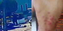 Motociclista leva tiro de bala de borracha e é espancado em abordagem de guardas municipais no RS  Foto: Reprodução/Redes Sociais