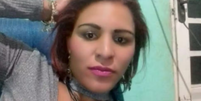 Mulher morre após ser atacada por pitbull em Três Corações, MG  Foto: Reprodução / Contigo
