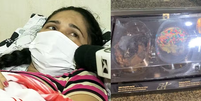 Mãe das crianças que morreram com ovo de páscoa envenenado diz que não desconfiou de presente  Foto: Reprodução/TV Mirante / Contigo