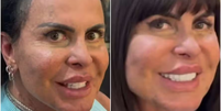 Para participar do Power Couple, Gretchen faz manutenção capilar: 'Três meses'  Foto: Reprodução/ Instagram / Contigo