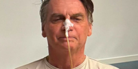Ex-presidente Jair Bolsonaro inicia alimentação oral na UTI: 'Persisto com sinais'  Foto: Reprodução/Instagram / Contigo