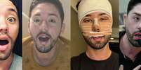 Antes e depois de Rico Melquiades: 40 fotos mostram mudança radical do influenciador com procedimentos estéticos.  Foto: Reprodução, Facebook/Divulgação Geraldo Magela/Agência Senado / Purepeople