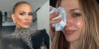 Jennifer Lopez sofre acidente em ensaio de premiação e leva pontos no rosto  Foto: Reprodução/Instagram