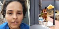 Mulher teve lábio arrancado por cachorro em RO  Foto: Reprodução/TikTok @nati.olegario e X @PopTime