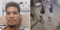 Ambulante de Fernando de Noronha que foi baleado por delegado tem perna amputada  Foto: Reprodução/Instagram