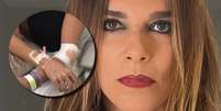 A atriz Mara Carvalho em selfie do Instagram e, no detalhe, os braços com curativos em foto postada por seu filho Bruno Fagundes  Foto: Reproduções