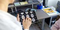Pesquisadores encontram novo método que pode reduzir tempo para diagnosticar tumores cerebrais  Foto: Reprodução/Getty Images