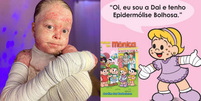 Influenciadora que morreu com doença genética rara vira personagem da Turma da Mônica  Foto: Reprodução/Instagram @jardimdasborboletas_