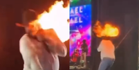 Cantor Léo sofre queimaduras no rosto após ser atingido por chamas durante show em SP  Foto: Reprodução/ Instagram / Contigo