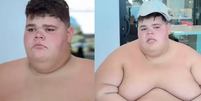 Gord&atilde;o da XJ emagrece 75kg e revela desejo inusitado  Foto: Reprodu&ccedil;&atilde;o / Contigo