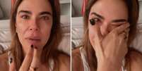 Luciana Gimenez entrega pavor de dormir após fazer cirurgia de hérnia de disco; entenda o que aconteceu com a famosa  Foto: Márcia Piovesan