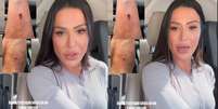 Gracyanne Barbosa sofre acidente e mostra fotos pelo Instagram   Foto: Reprodução / Gávea News