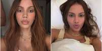 Anitta aparece com rosto diferente e gera curiosidade sobre procedimentos realizados Foto: Reprodução/Instagram