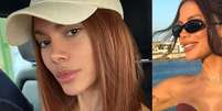 'Irreconhecível': Anitta abre álbum de fotos com selfies e nova aparência após procedimento estético volta a viralizar nos comentários.  Foto: Reprodução, Instagram / Purepeople