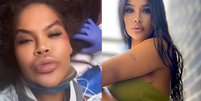 Ex-Big Brother se acidenta e reclama da falta de socorro  Foto: reprodução/instagram / Contigo