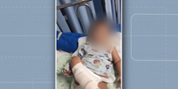 Heitor Gustavo Ribeiro havia sido internado inicialmente no Hospital Materno-Infantil Dr. Joaquim Sampaio, em Ilhéus (BA), mas desenvolveu uma infecção grave que levou à necrose do membro  Foto: Reprodução/TV Bahia