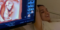 Após perda dolorosa, Rafa Kalimann emociona web ao mostrar ultrassom da filha: 'Não acho justo' Foto: Reprodução/ Instagram / Contigo