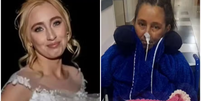 Mulher é internada para laqueadura e acorda sem perna e com transplante de coração Foto: Reprodução / Contigo