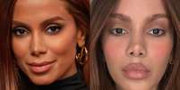 Lifting endoscópio e lifting labial: cirurgião plástico lista 4 indícios de que Anitta passou pelos 2 procedimentos estéticos.  Foto: Divulgação, TV Globo/Reprodução Instagram / Purepeople