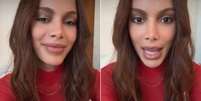Anitta faz live para esclarecer os procedimentos estéticos realizados em seu rosto  Foto: Via Instagram @gqdaanitta ] / Estadão