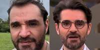 Antes e depois: Marcelo Cosme parece alguns anos mais jovem ap&oacute;s o implante  Foto: Reprodu&ccedil;&otilde;es