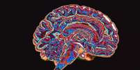 A neurociência começou a explorar como o poder político e o contexto institucional influenciam a atividade cerebral associada a decisões corruptas ou imorais. Foto: Getty Images / BBC News Brasil