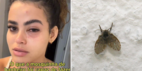 Jovem vai parar no médico após mosca entrar no olho: ‘Desesperada’  Foto: Reprodução/Tik Tok