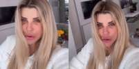 Íris Stefanelli fez cirurgias no rosto  Foto: Reprodução/Instagram / Mais Novela
