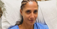 Médico explica doença silenciosa que afetou Camila Pitanga e desperta preocupação no mundo todo: ‘Pode deixar marcas nos pulmões’.  Foto: Reprodução, Instagram / Purepeople