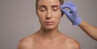 Blefaroplastia é uma cirurgia nas pálpebras  Foto: Freepik