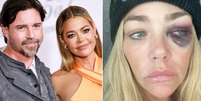 Atriz Denise Richards exp&otilde;e terror vivido com ex  Foto: reprodu&ccedil;&atilde;o/ Getty Images e TMZ / Contigo