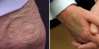 Antes de diagnóstico, Trump foi flagrado com mão maquiada e pés inchados Foto: Reprodução/Youtube