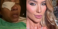 Virgínia Fonseca pede R$ 20 mil em processo contra youtuber que viralizou caso da cliente da WePink que quase ficou cega: ‘Linchamento’.  Foto: Reprodução, Instagram / Purepeople