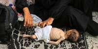 Uma a cada cinco crian&ccedil;as est&aacute; desnutrida em Gaza, segundo a ag&ecirc;ncia humanit&aacute;ria da ONU  Foto: Reuters / BBC News Brasil