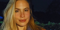 Atriz de Malhação perde a visão em relacionamento abusivo Foto: Reprodução/ Instagram / Contigo