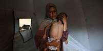 Mãe segura bebê de 18 meses com sinais de desnutrição em campo de refugiados em Gaza  Foto: ANSA / Ansa - Brasil