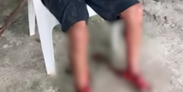 Imagens do homem após o ataque dos cachorros viralizam nas redes sociais  Foto: Reprodução/Facebook/Guarujá Mil Grau