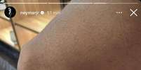 Neymar posta foto da perna machucada após duelo com o Fluminense.  Foto: Reprodução/@Neymarjr Instagram / Estadão