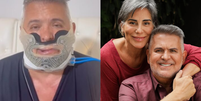 &Eacute; grave Marido de Gloria Pires passa por cirurgia delicada  Foto: Contigo