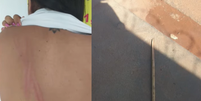 Ex-companheiro agride mulher com cabo de rodo durante conversa sobre filhos em Uberlândia  Foto: Reprodução/Cidade Alerta/TV Paranaíba