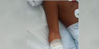 Menor de 8 anos ficou gravemente ferido  Foto: Reprodução