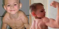 Giuliano Stroe, o menino mais forte do mundo, aos 5 anos  Foto: Foto/Reprodução / Contigo
